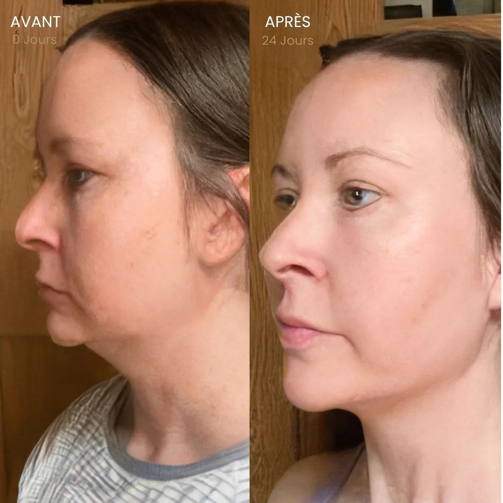 Brosse Lymphatique Visage