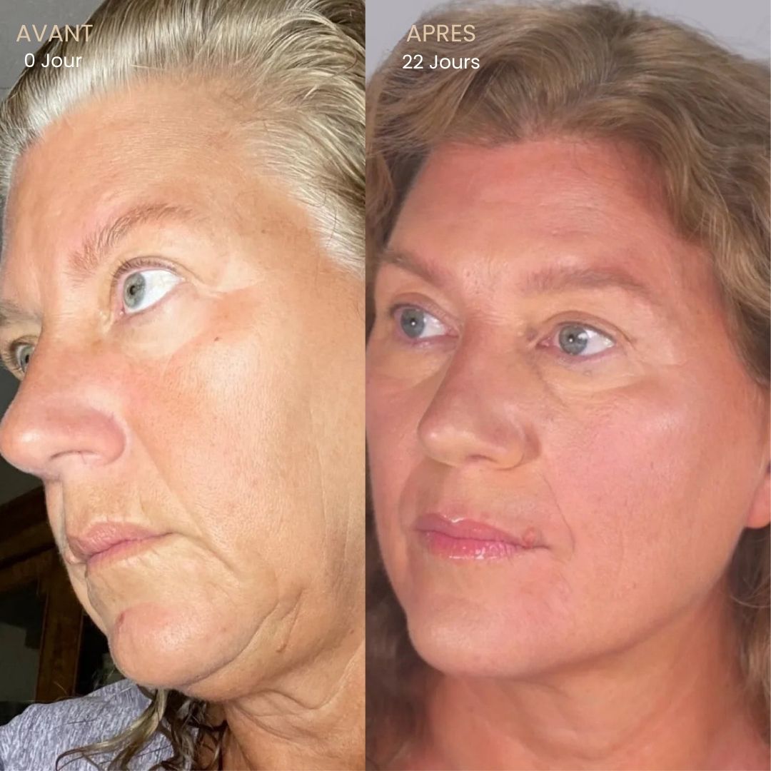 Brosse Lymphatique Visage