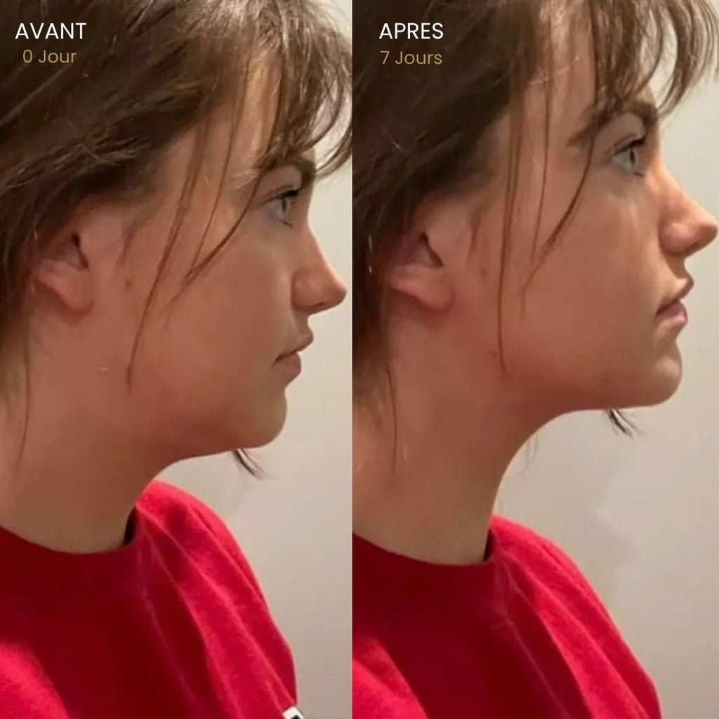 Brosse Lymphatique Visage