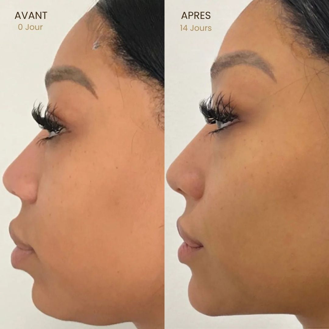 Brosse Lymphatique Visage