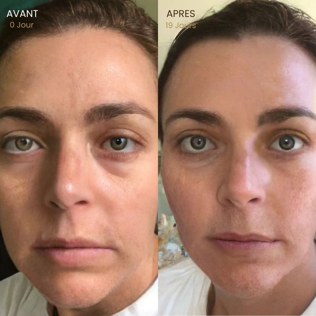 Brosse Lymphatique Visage